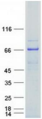 Coomassie blue staining of purified PGM3 protein.
